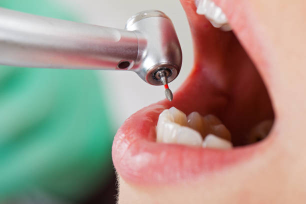 Best Emergency Broken Tooth Repair in East Harwich, MA